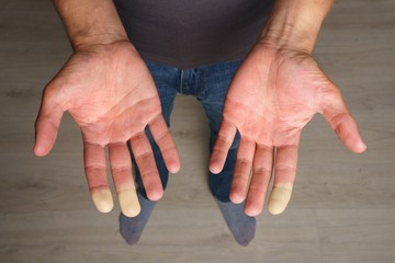fázékonyság, pajzsmirigy, vérszegénység, anyagcsere, Raynaud