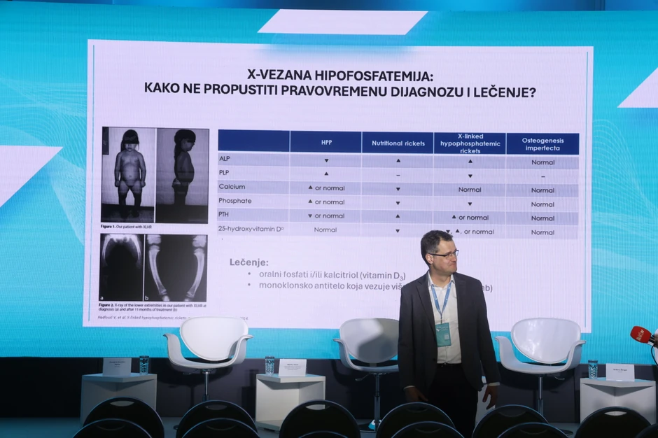 Krive noge mogu biti znak retke bolesti