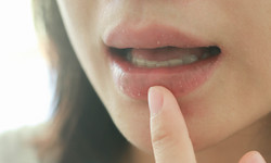 Objawy cukrzycy widać w ustach. Dwa sygnały alarmowe