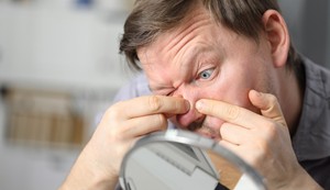 Prisilno istiskivanje mitesera može da iziritira područje na kome se nalazi