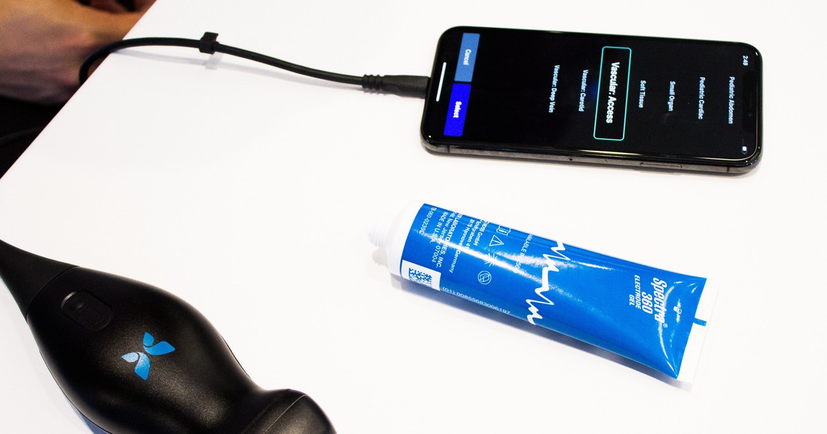 Tech A startup that makes a new iPhone ultrasound device, whose chief