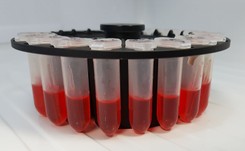 Przełomowe odkrycie polskich naukowców. Pomoże szybciej diagnozować stwardnienie rozsiane