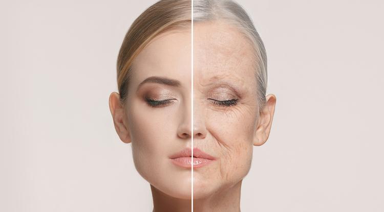 Lehetséges: 5 módszer az öregedés megállítására fotó: Getty Images