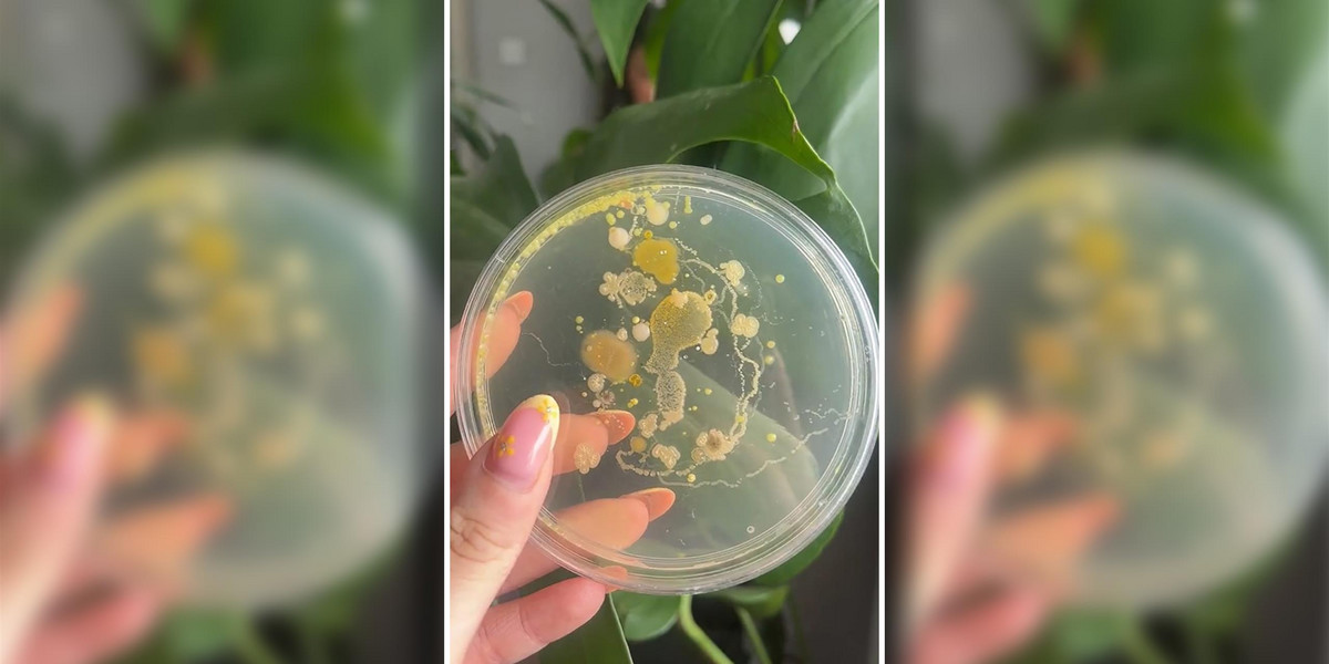 Gdzie znajduje się najwięcej bakterii na naszym ciele? Wcale nie na naszych rękach.