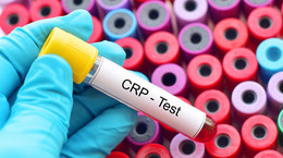 Białko C-reaktywne (CRP) - wskazania do badania, normy, przyczyny podwyższonego CRP