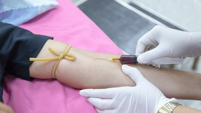Így segíti az Országos Vérellátó szolgálat a véradókat