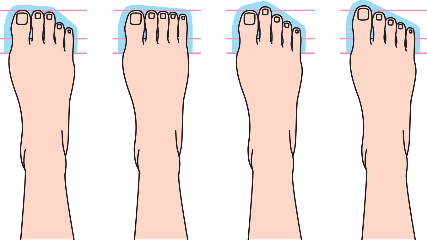 Tri základné typy chodidiel – egyptské, grécke a rímske. (Ilustračný obrázok)