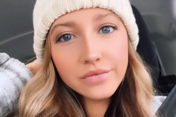 Ovako je izgledala pre nego što joj je PAS ODGRIZAO NOS: Lekari su OD KOŽE SA ČELA napravili novi i posle 16 OPERACIJA konačno je smogla snage da se POGLEDA U OGLEDALO