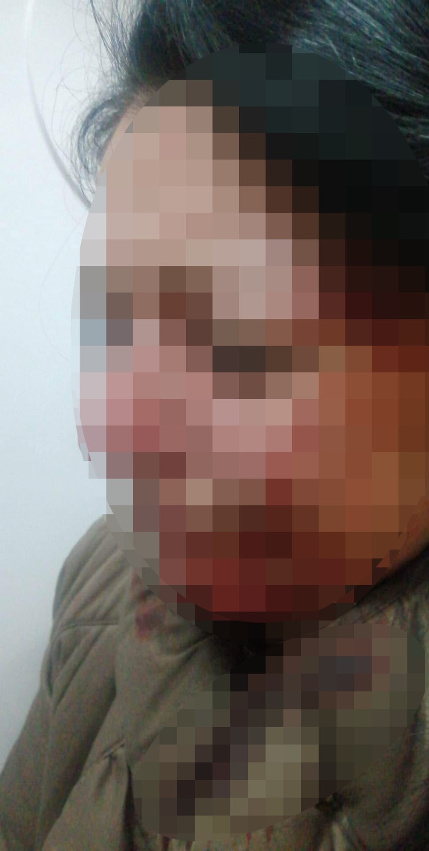 Nesrećna žena bila je sva krvava u licu