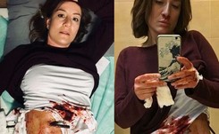 Maja Ostaszewska pokazała przerażające zdjęcia z planu 'Diagnozy' [GALERIA]