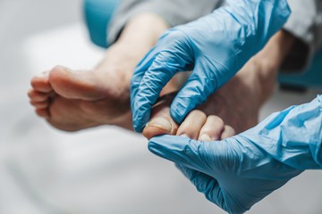 A bőrrák leghalálosabb típusa érintheti a többi között a szemet, illetve a különböző nyálkahártyákat, valamint a körmöket: a körmök alatt és környékén is kialakulhat, beleértve a kéz- és a lábkörmöket egyaránt. Az Amerikai Bőrgyógyászati Akadémia (AAD) közlése szerint körömmelanoma összességében gyakrabban fordul elő idős és sötétebb bőrű embereknél, de a kockázati tényezők közé tartozik a személyes vagy családi kórtörténet, ahogy a körmöt ért trauma is.