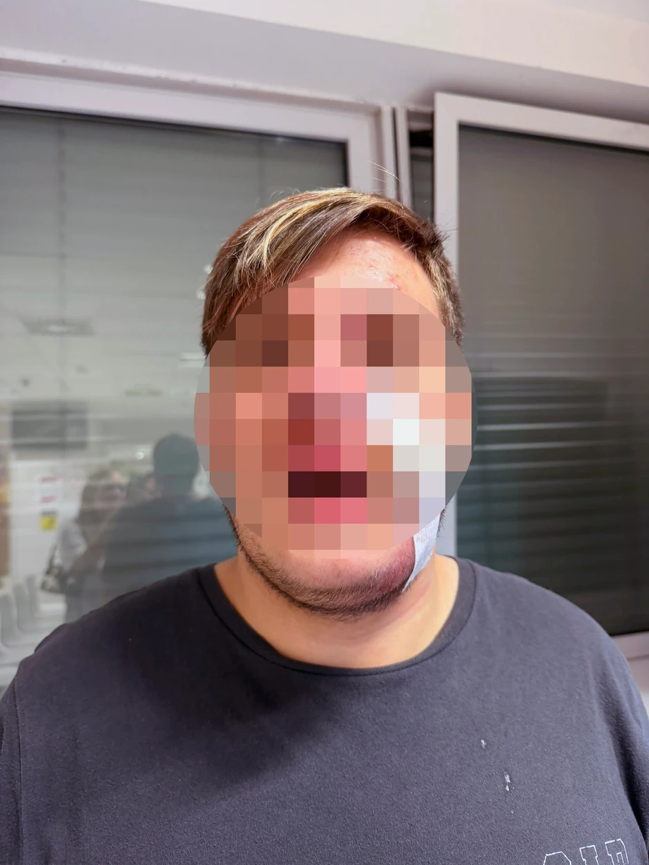 Pretučen tinejdžer 