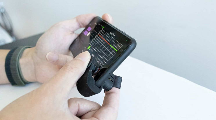 A telefon kameráját használva méri a vérnyomást /Fotó: Digital Health Lab UC San Diego