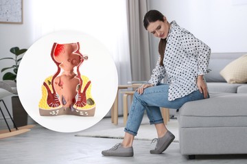 negyedik stádium előrehaladott aranyér tünete