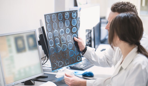 Rredak, ali težak oblik dečje epilepsije uzrokovan je pojedinačnom mutacijom na SCN2A genu