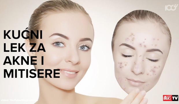 Sorti_akne_mitiseri_vesti_blic_safe