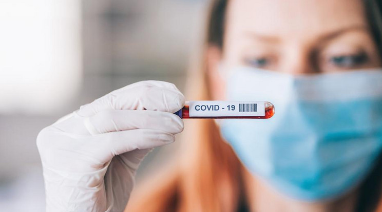 Nem a betegnek kell fizetnie a vírus örökítőanyagát kimutatni képes PCR-teszt elvégzéséért / Illusztráció: GettyImages