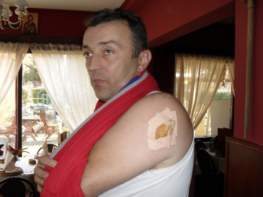 Dejan Milenković izbegao je, srećom, teže ranjavanje