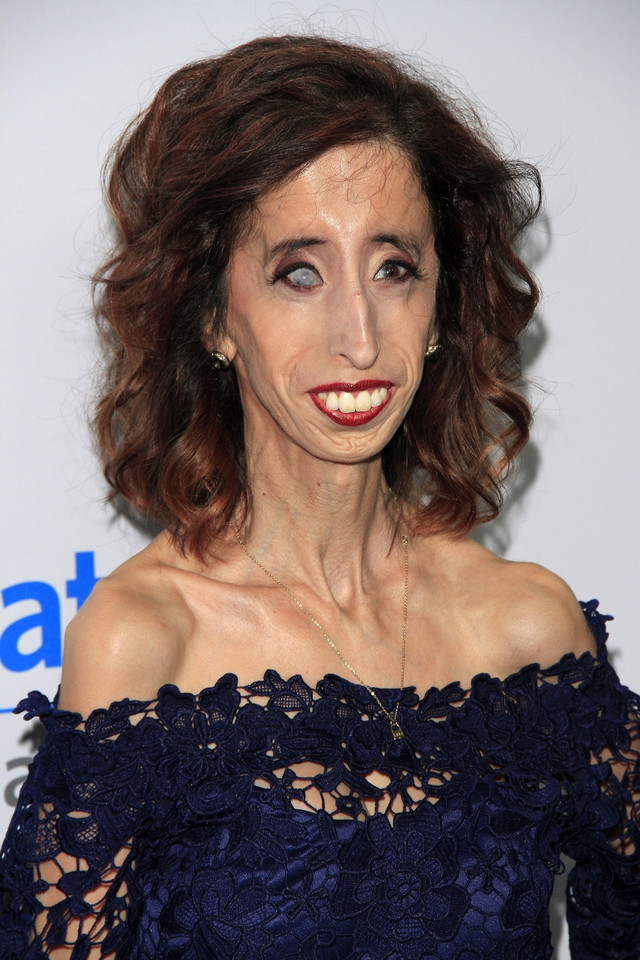 Lizzie Velasquez na konferencji "We Day"