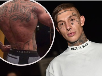 ŠTA SE DOGODILO SA LEĐIMA NEKADAŠNJEG ZADRUGARA? Svi gledaju u jedan detalj i pitaju se da li je sve okej
