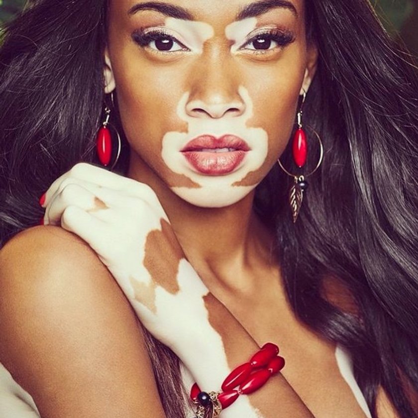 Winnie Harlow