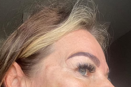 "Izgledam kao da IMAM CRVE U OBRAZU"! Natalija (53) otišla kod kozmetičarke na ZATEZANJE LICA, pa se IZOBLIČILA: Nije sinu otišla na 30. rođendan, a onda je SPAS NAŠLA U TURSKOJ