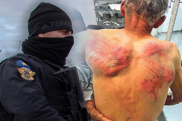 PUCNJAVE, PREBIJANJA, NAPADI NA DECU! Geneza nasilja nad Srbima na Kosovu i Metohiji: Ovo je teror koji Kurtijev režim sprovodi dok Zapad ćuti (FOTO)