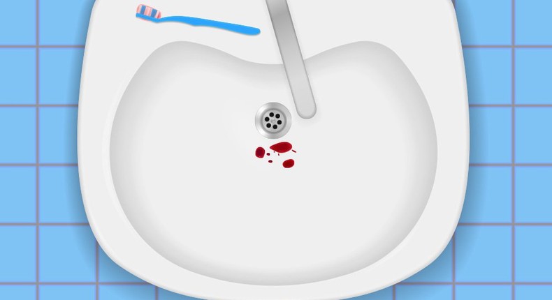 5 reasons why your gums are bleeding when you brush 