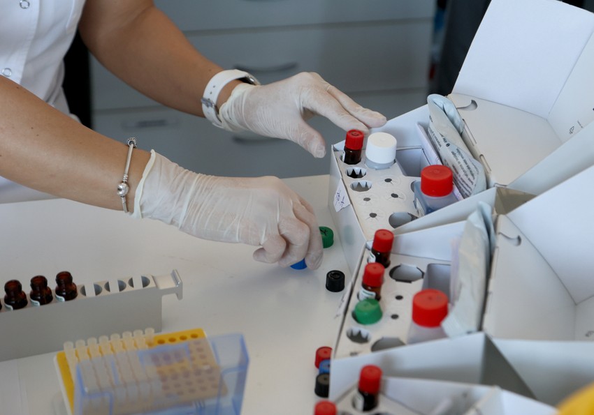 Prvi korak kod otkrivanja uzroka žutice je analiza krvi