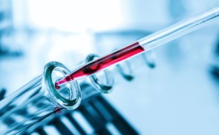 Grupa krwi ma duży wpływ na ryzyko Covid-19. Jedna grupa szczególnie narażona