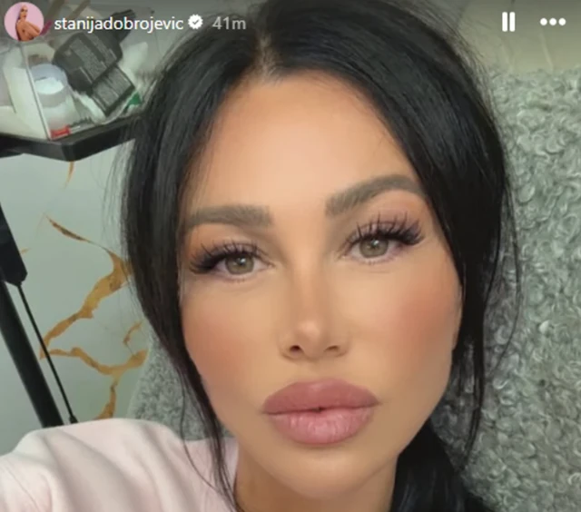 NI NALIK STAROJ! Stanija Dobrojević prošla niz tretmana pred SUSRET SA Asminom u "Eliti 9" - PAŠĆE VILICA KADA JE UGLEDA! (FOTO)