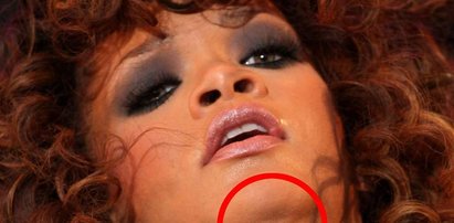 Rihanna miała operację plastyczną?