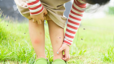 Jak skutecznie odstraszyć komary? Kilka sprawdzonych sposobów