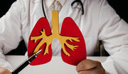 Jakie są objawy zatorowości płucnej? Lekarz wymienia najczęstsze