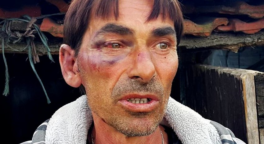 Pretučen Ivica Matin