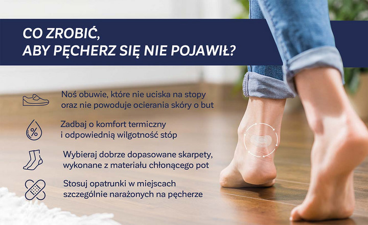 Co zrobić, aby pęcherz się nie pojawił? - infografika