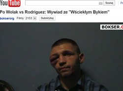 Twarz jak z horroru. Tak rywal "urządził" polskiego boksera