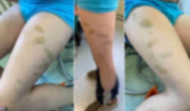 Vršnjačko nasilje na ekskurziji