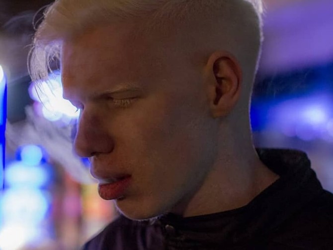 Albino Svemogući 
