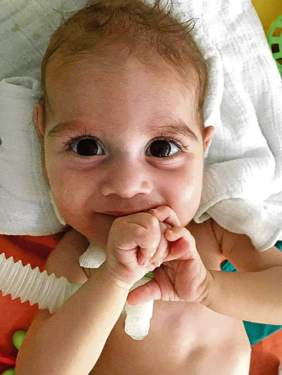 Oliveru je sa mesec dana konstatovana SMA 1. Bolest se manifestuje na početku atrofijom mišića da bi se posle gubile životne funkcije - varenje, gutanje, disanje.