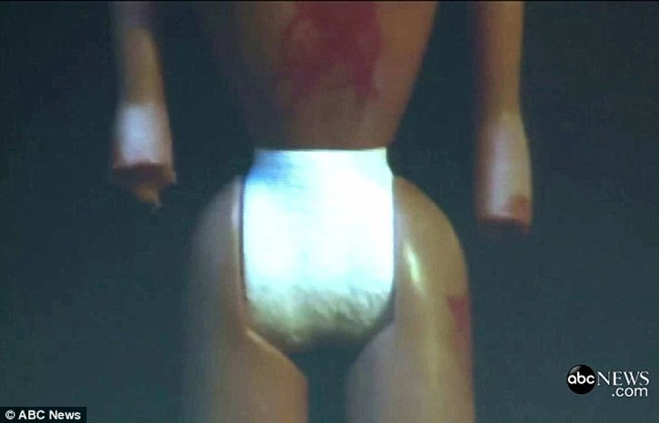 ... i odsečenih udova