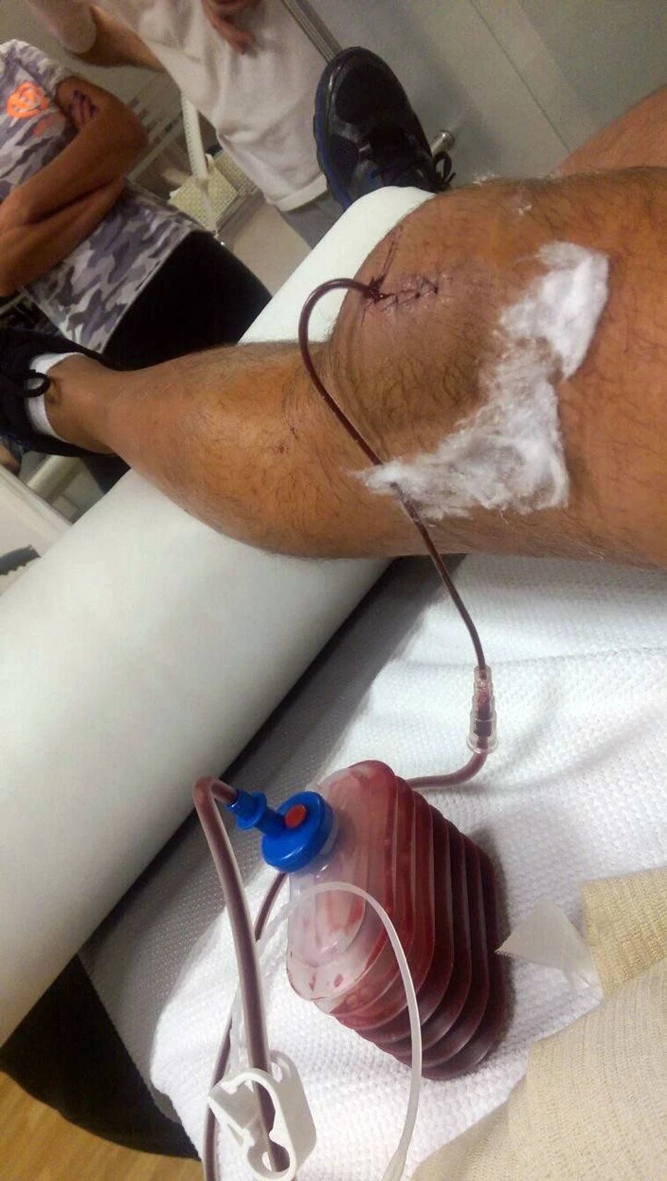 Povreda kolena Čede Jovanovića