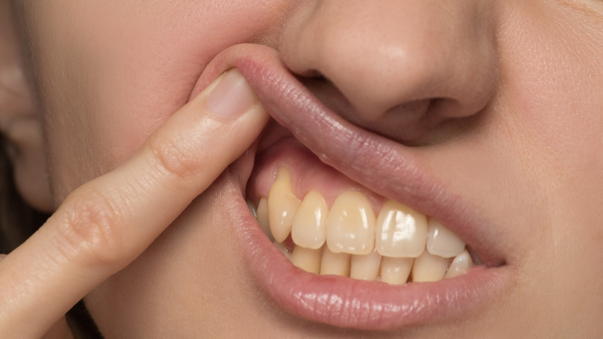 Sekret białych zębów: babciny trik, który cudownie działa!