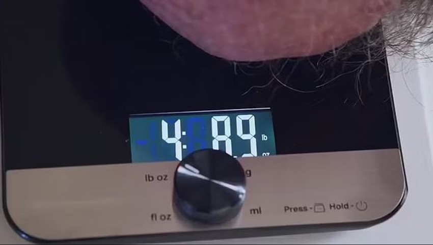 Tumor koji je Tim imao godinama na licu