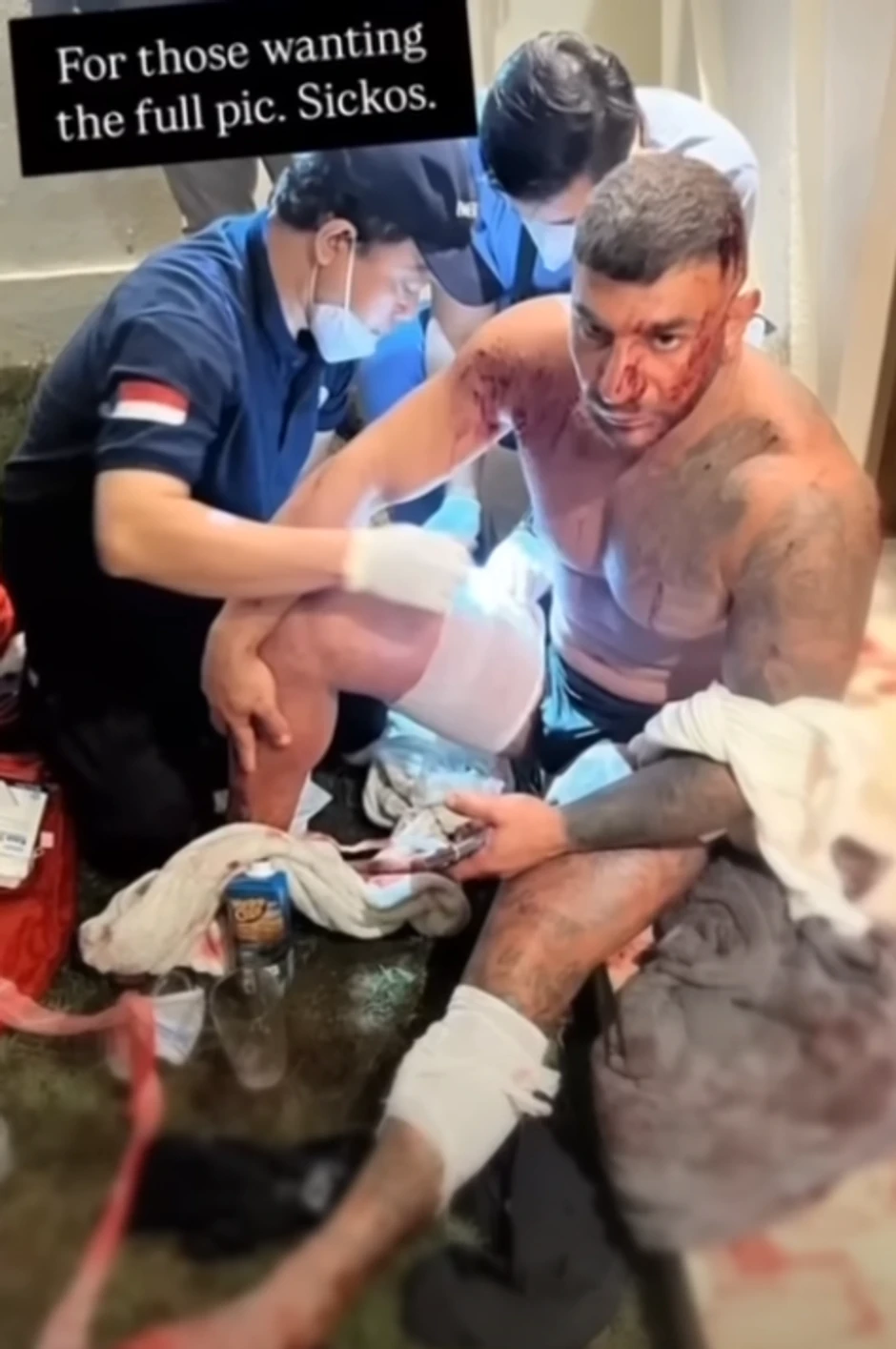 Teško ranjen Radmanovićev prijatelj Sanar Ganim