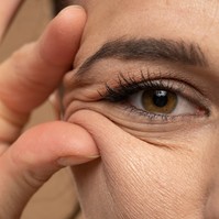 Mire jó a kollagén? A legtöbb nőnek fogalma sincs erről