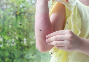 Prirodne metode mogu brzo da ublaže svrab izazvan ubodom komarca