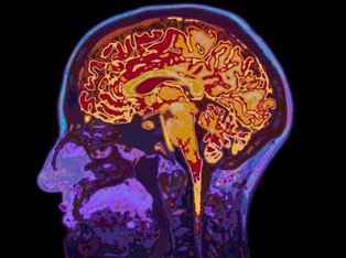 Można skuteczniej dostarczać leki przez barierę krew-mózg [BADANIA]