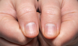 Wygląd paznokci zdradza, jakie masz niedobory w organizmie