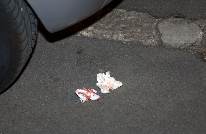 Na mestu incidenta ostale su krvave maramice